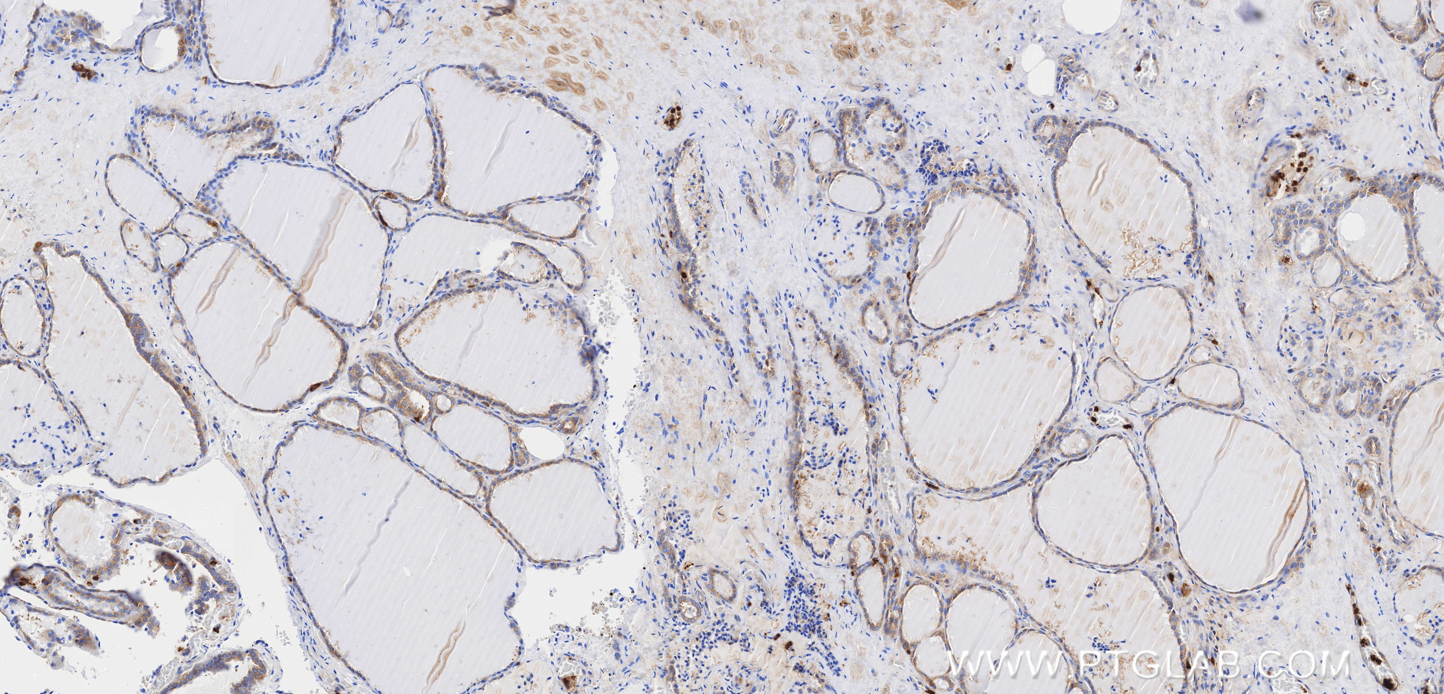 Immunohistochemistry (IHC) staining of human thyroid tissue using AP2S1 Recombinant monoclonal antibody (84174-3-RR)