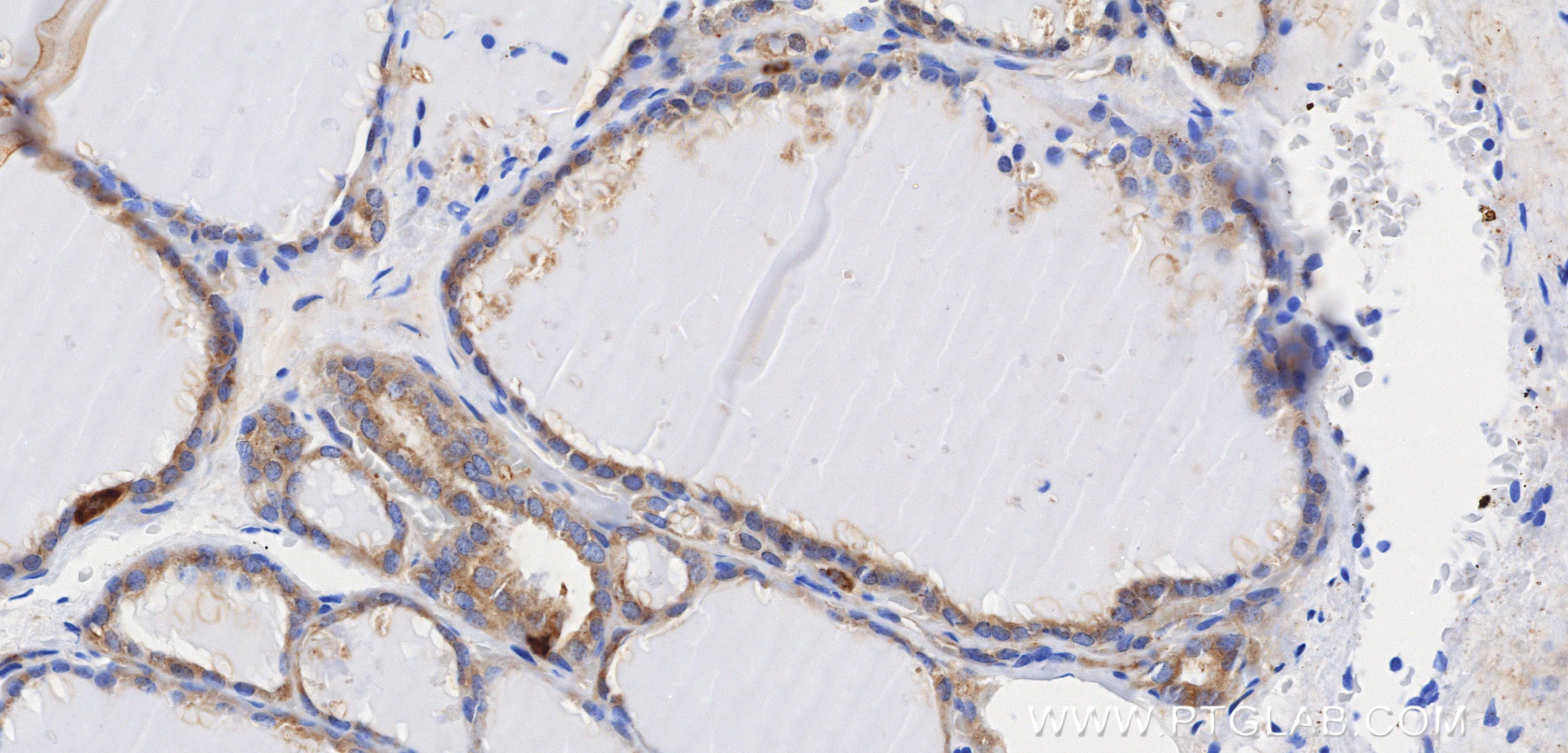 Immunohistochemistry (IHC) staining of human thyroid tissue using AP2S1 Recombinant monoclonal antibody (84174-3-RR)
