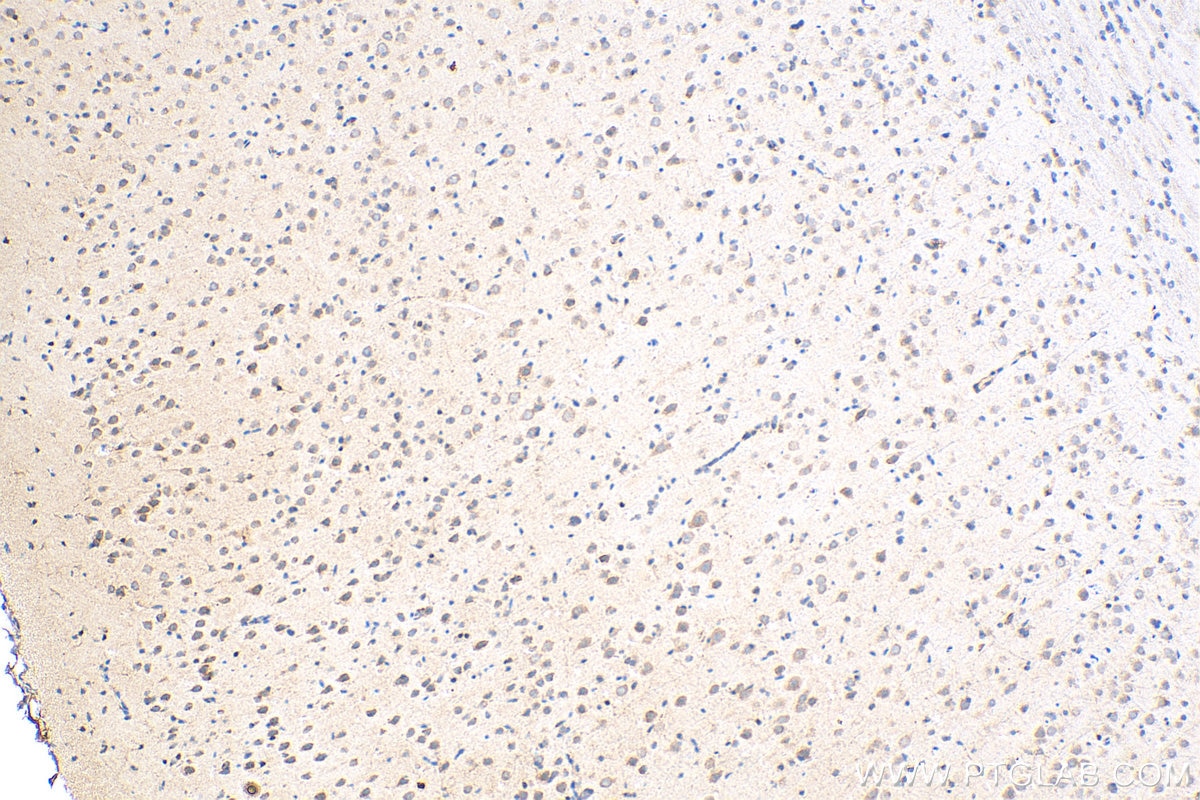 Immunohistochemistry (IHC) staining of rat brain tissue using AP3B1 Polyclonal antibody (13384-1-AP)
