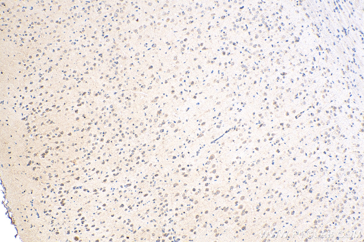 IHC staining of rat brain using 13384-1-AP