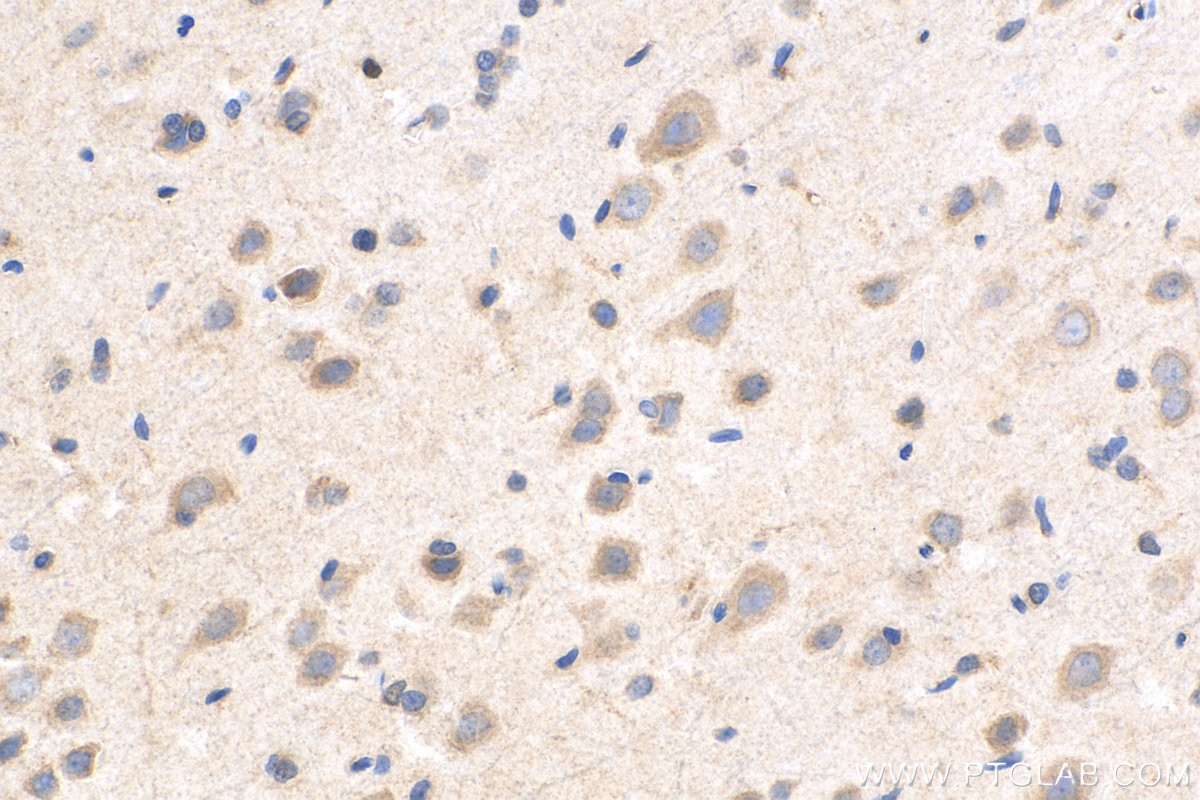 Immunohistochemistry (IHC) staining of rat brain tissue using AP3B1 Polyclonal antibody (13384-1-AP)