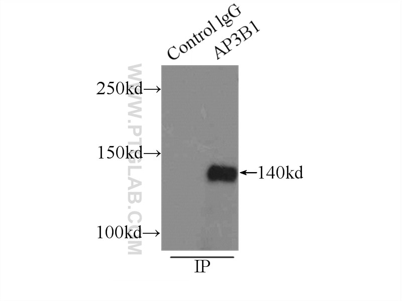 Immunoprecipitation (IP) experiment of COLO 320 cells using AP3B1 Polyclonal antibody (13384-1-AP)