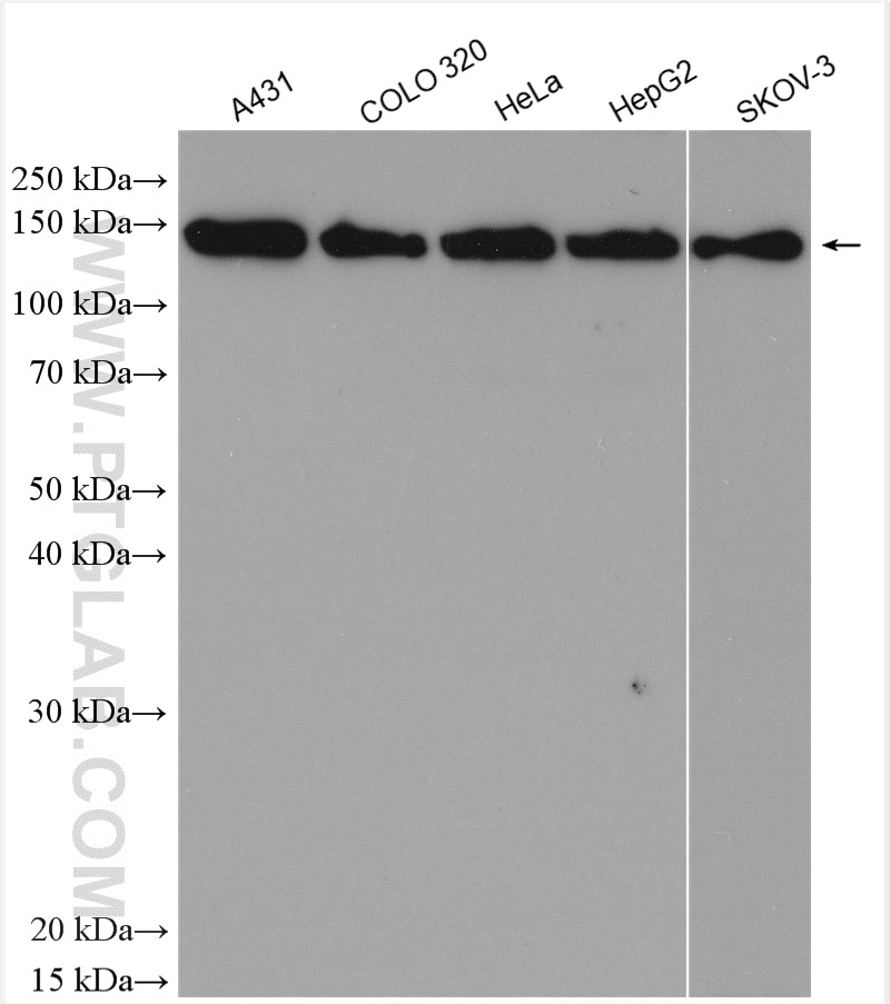 Western Blot (WB) analysis of various lysates using AP3B1 Polyclonal antibody (13384-1-AP)