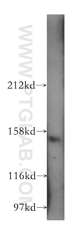 Western Blot (WB) analysis of mouse thymus tissue using AP3B1 Polyclonal antibody (13384-1-AP)