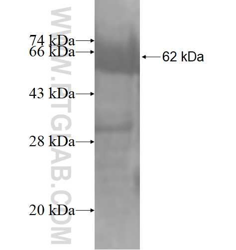 AP3B1 fusion protein Ag4225 SDS-PAGE