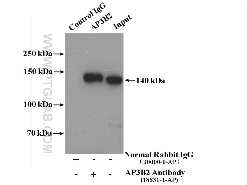 Immunoprecipitation (IP) experiment of mouse brain tissue using AP3B2 Polyclonal antibody (18331-1-AP)