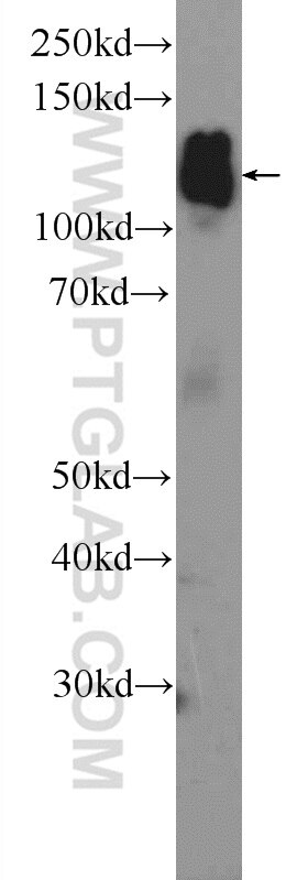 Western Blot (WB) analysis of mouse brain tissue using AP3B2 Polyclonal antibody (18331-1-AP)