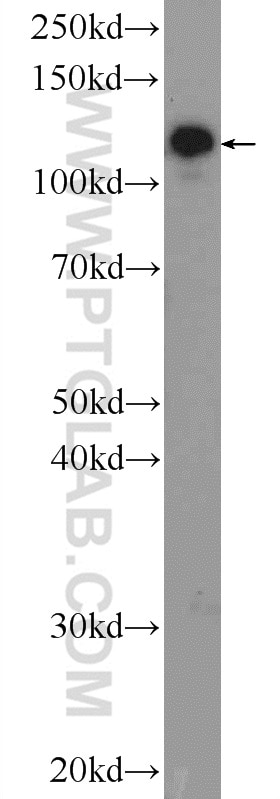 Western Blot (WB) analysis of rat brain tissue using AP3B2 Polyclonal antibody (18331-1-AP)