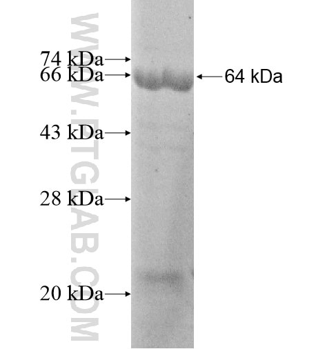 AP3B2 fusion protein Ag12861 SDS-PAGE