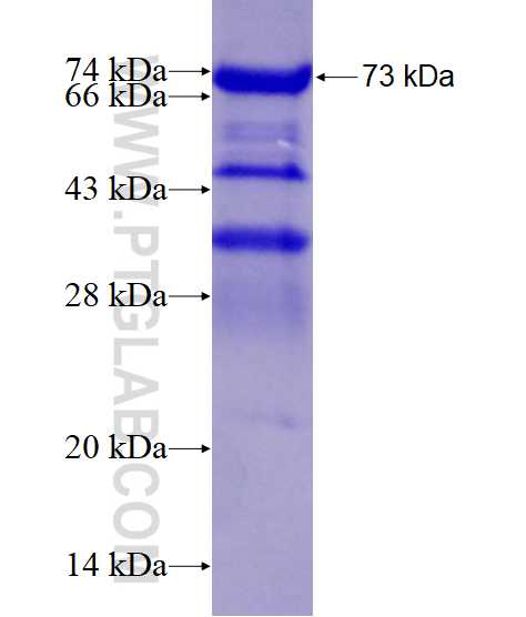 AP3B2 fusion protein Ag13021 SDS-PAGE