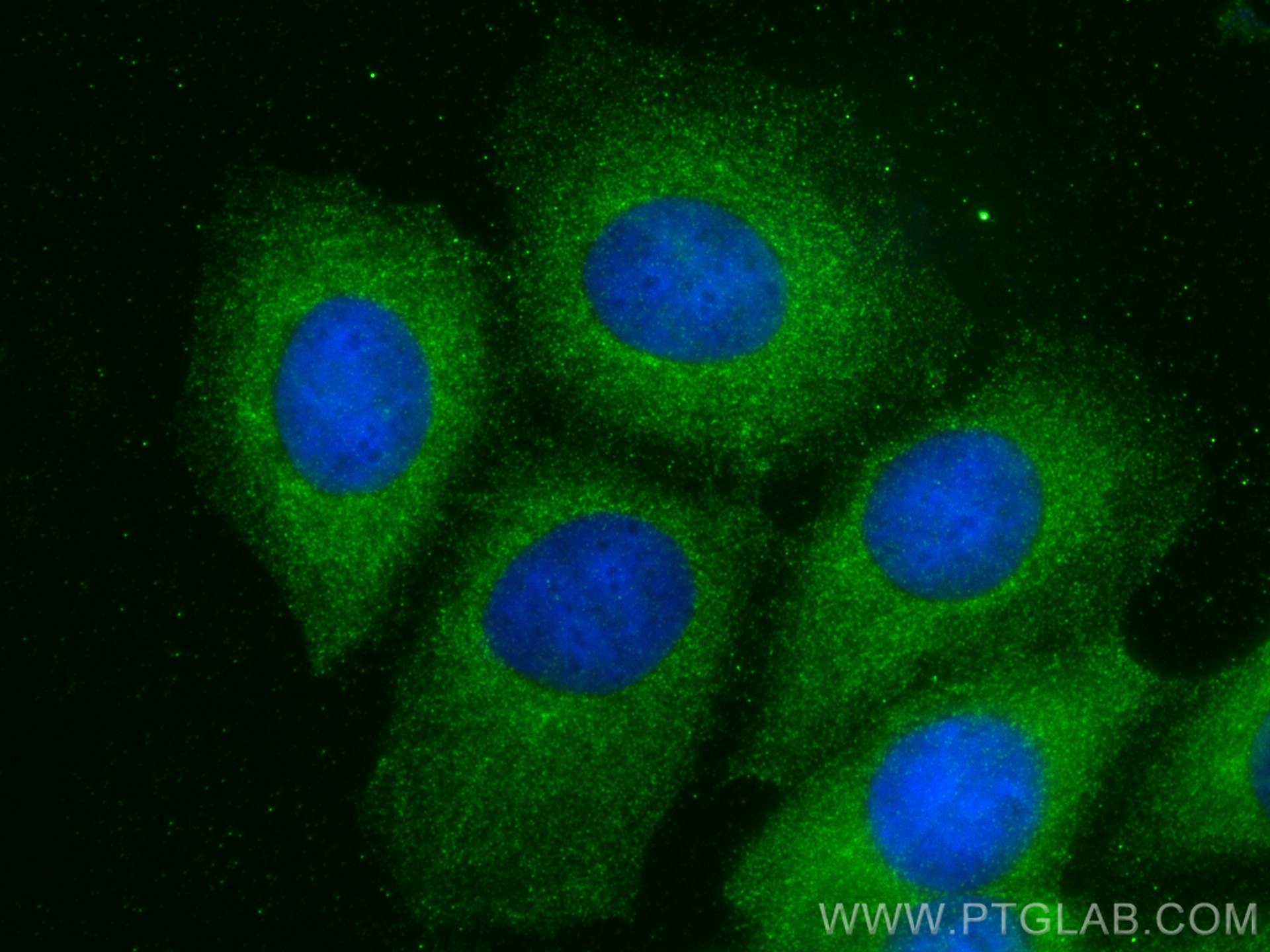 Immunofluorescence (IF) / fluorescent staining of MCF-7 cells using AP3D1 Polyclonal antibody (16454-1-AP)