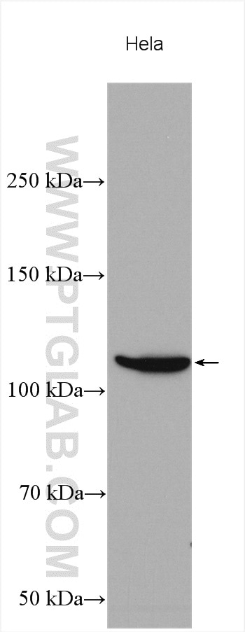 Western Blot (WB) analysis of various lysates using AP3D1 Polyclonal antibody (16454-1-AP)