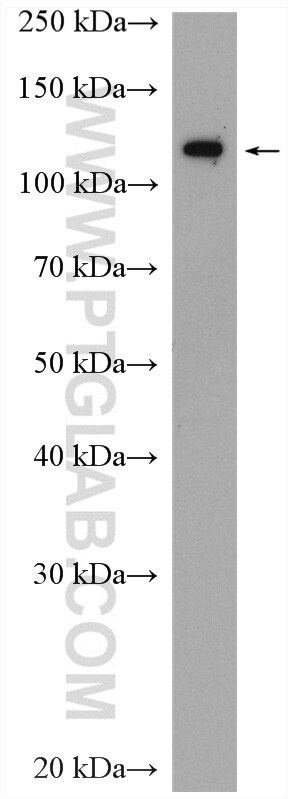 Western Blot (WB) analysis of NIH/3T3 cells using AP3D1 Polyclonal antibody (16454-1-AP)