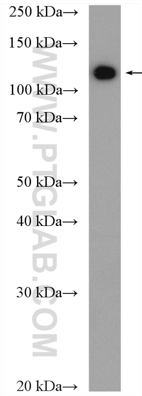 Western Blot (WB) analysis of HepG2 cells using AP3D1 Polyclonal antibody (16454-1-AP)