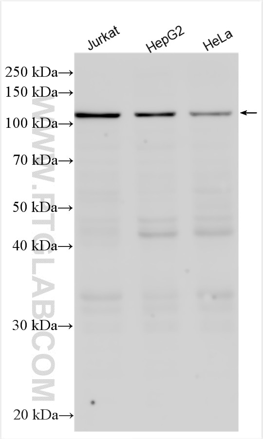 Western Blot (WB) analysis of various lysates using AP3D1 Polyclonal antibody (16454-1-AP)