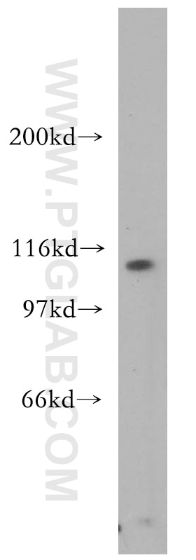 AP3D1 Polyclonal antibody