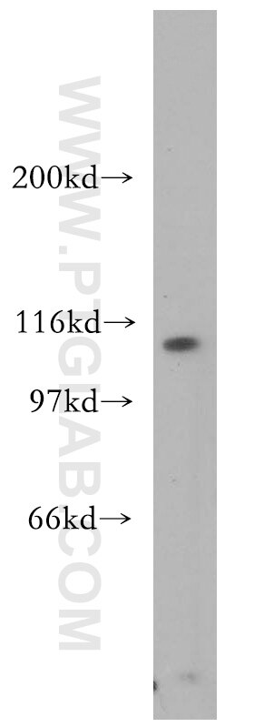 AP3D1 Polyclonal antibody