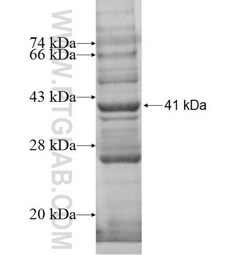 AP3D1 fusion protein Ag9390 SDS-PAGE