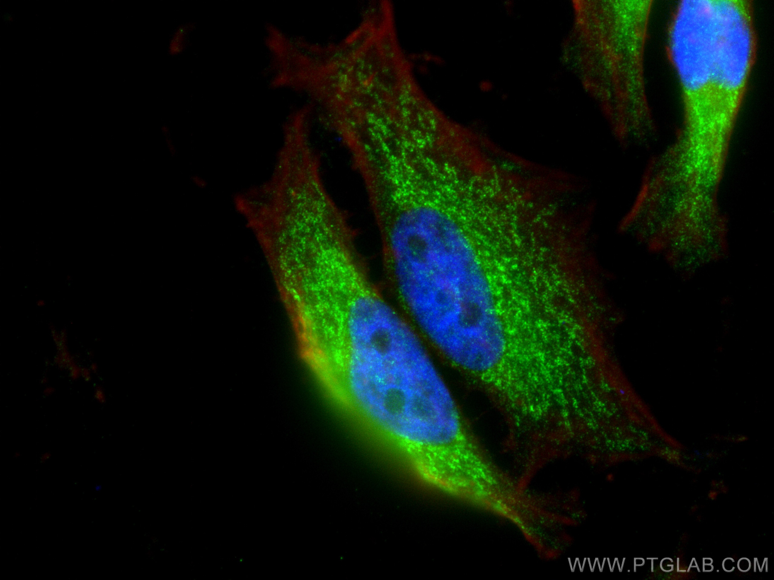 Immunofluorescence (IF) / fluorescent staining of HeLa cells using AP3M1 Polyclonal antibody (12114-1-AP)