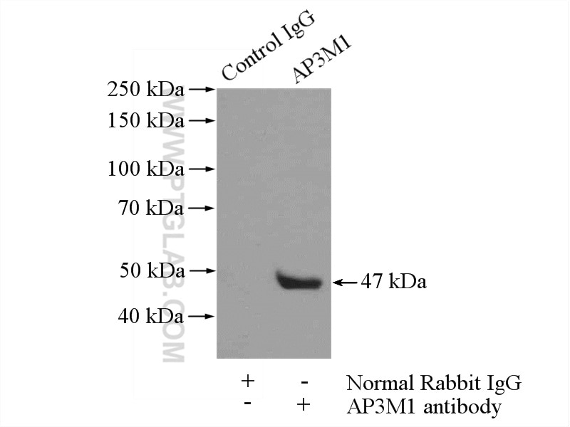 Immunoprecipitation (IP) experiment of NIH/3T3 cells using AP3M1 Polyclonal antibody (12114-1-AP)