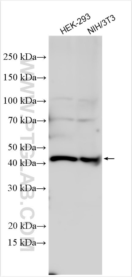 Western Blot (WB) analysis of various lysates using AP3M1 Polyclonal antibody (12114-1-AP)