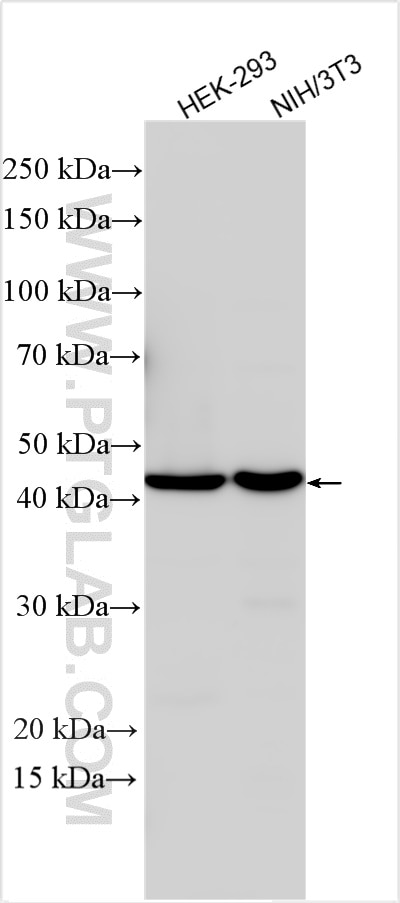 Western Blot (WB) analysis of various lysates using AP3M1 Polyclonal antibody (12114-1-AP)