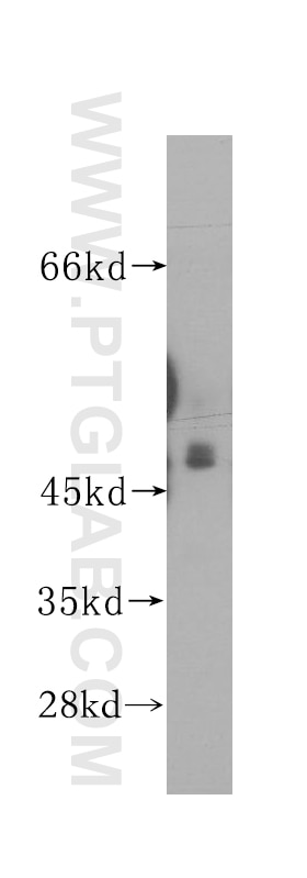 Western Blot (WB) analysis of NIH/3T3 cells using AP3M1 Polyclonal antibody (12114-1-AP)