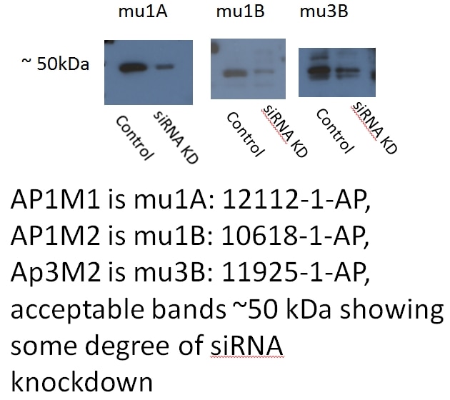 Western Blot (WB) analysis of Hacat cells (siRNA) using AP3M2 Polyclonal antibody (11925-1-AP)