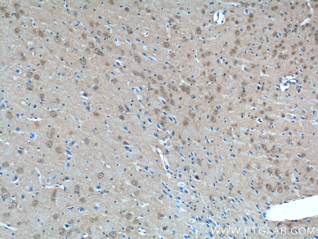 Immunohistochemistry (IHC) staining of mouse brain tissue using AP3M2 Polyclonal antibody (11925-1-AP)