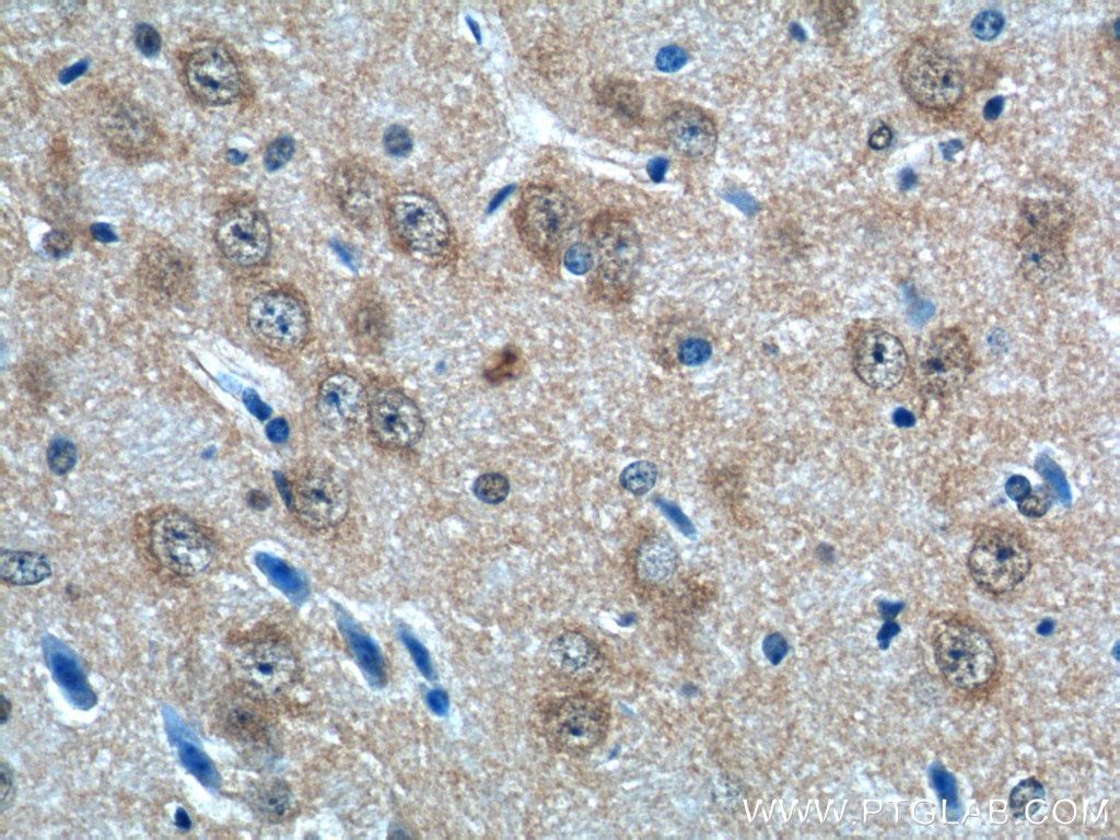 Immunohistochemistry (IHC) staining of mouse brain tissue using AP3M2 Polyclonal antibody (11925-1-AP)