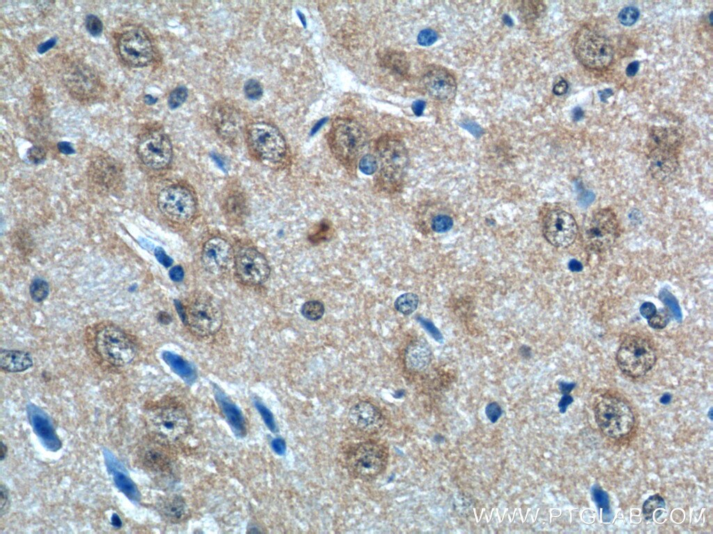 IHC staining of mouse brain using 11925-1-AP