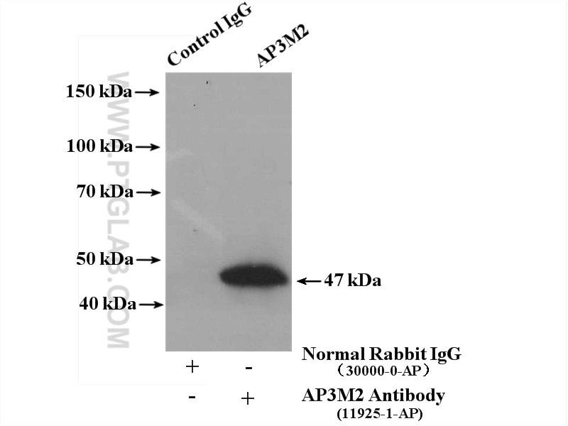 Immunoprecipitation (IP) experiment of mouse brain tissue using AP3M2 Polyclonal antibody (11925-1-AP)