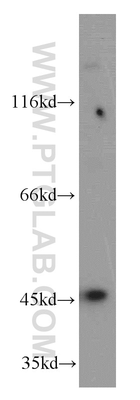 Western Blot (WB) analysis of human brain tissue using AP3M2 Polyclonal antibody (11925-1-AP)