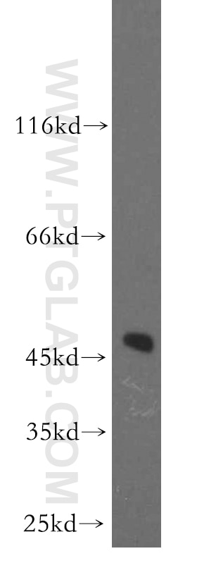 AP3M2 Polyclonal antibody