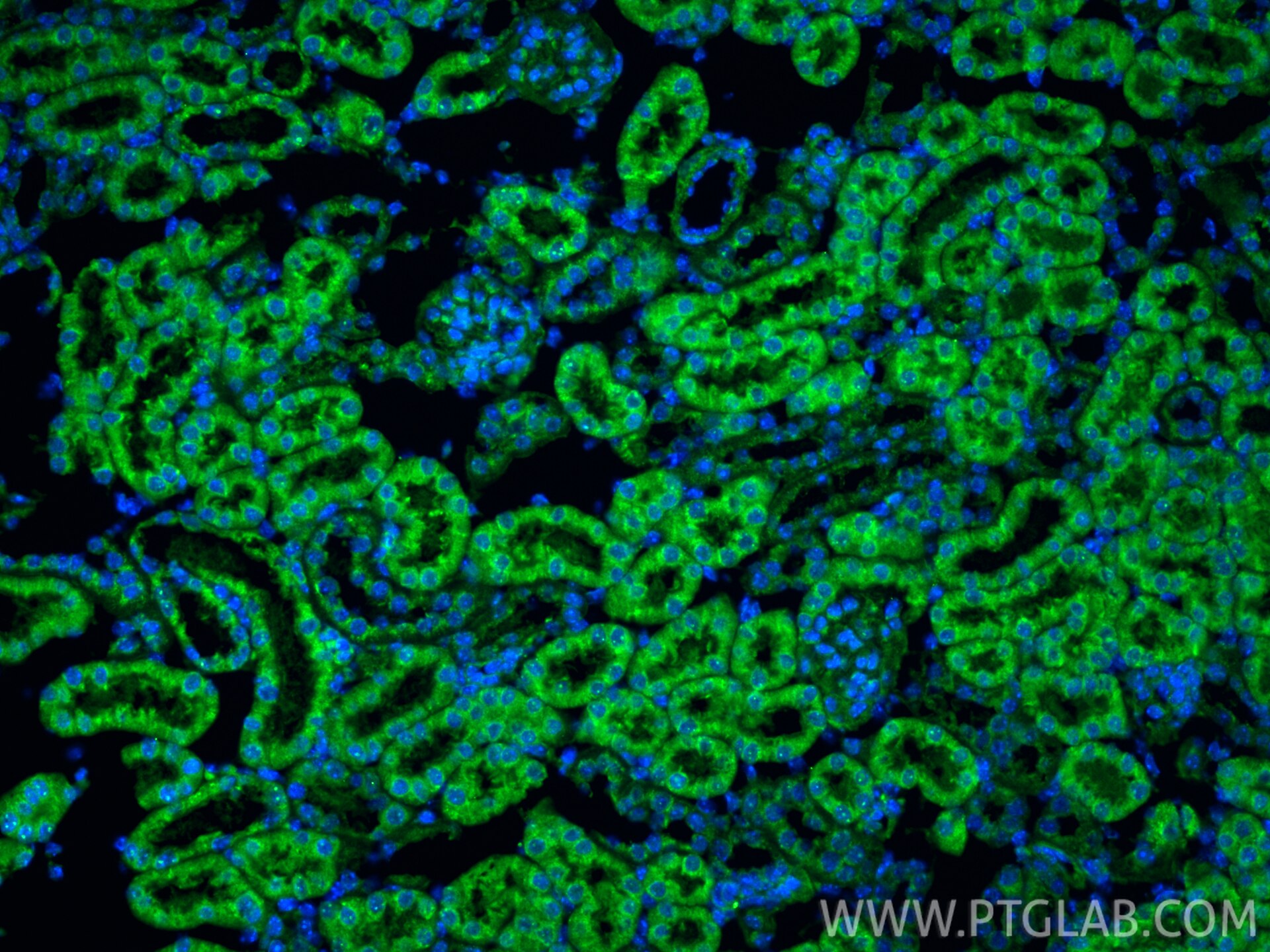 IF Staining of mouse kidney using 32945-1-AP Immunofluorescence (IF) / fluorescent staining of mouse kidney tissue using AP3S1 Polyclonal antibody (32945-1-AP)