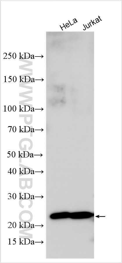 WB analysis using 32945-1-AP Western Blot (WB) analysis of various lysates using AP3S1 Polyclonal antibody (32945-1-AP)
