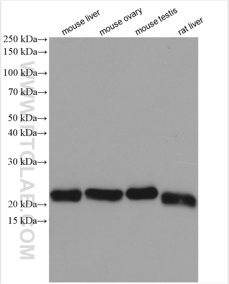 Western Blot (WB) analysis of various lysates using AP3S2 Polyclonal antibody (15319-1-AP)