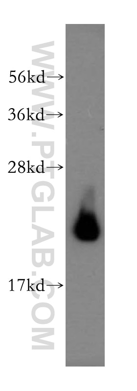 Western Blot (WB) analysis of human testis tissue using AP3S2 Polyclonal antibody (15319-1-AP)