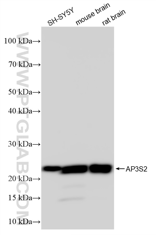 Various lysates were subjected to SDS PAGE followed by western blot with 86795-1-RR (AP3S2 antibody) at dilution of 1:10000 incubated at room temperature for 1.5 hours. Western Blot (WB) analysis of various lysates using AP3S2 Recombinant monoclonal antibody (86795-1-RR)