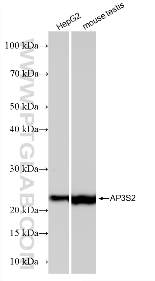 Various lysates were subjected to SDS PAGE followed by western blot with 86795-1-RR (AP3S2 antibody) at dilution of 1:10000 incubated at room temperature for 1.5 hours. Western Blot (WB) analysis of various lysates using AP3S2 Recombinant monoclonal antibody (86795-1-RR)