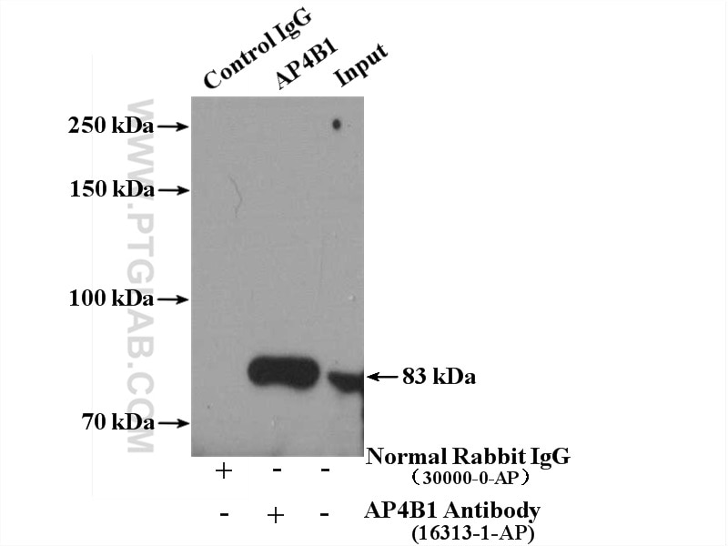 Immunoprecipitation (IP) experiment of HeLa cells using AP4B1 Polyclonal antibody (16313-1-AP)