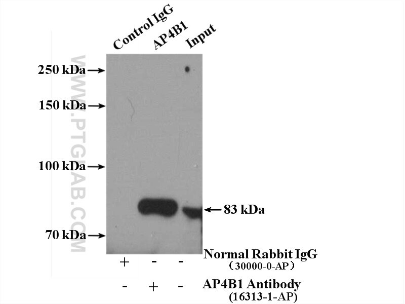 Immunoprecipitation (IP) experiment of HeLa cells using AP4B1 Polyclonal antibody (16313-1-AP)