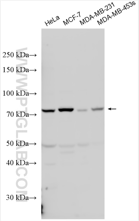 Western Blot (WB) analysis of various lysates using AP4B1 Polyclonal antibody (16313-1-AP)