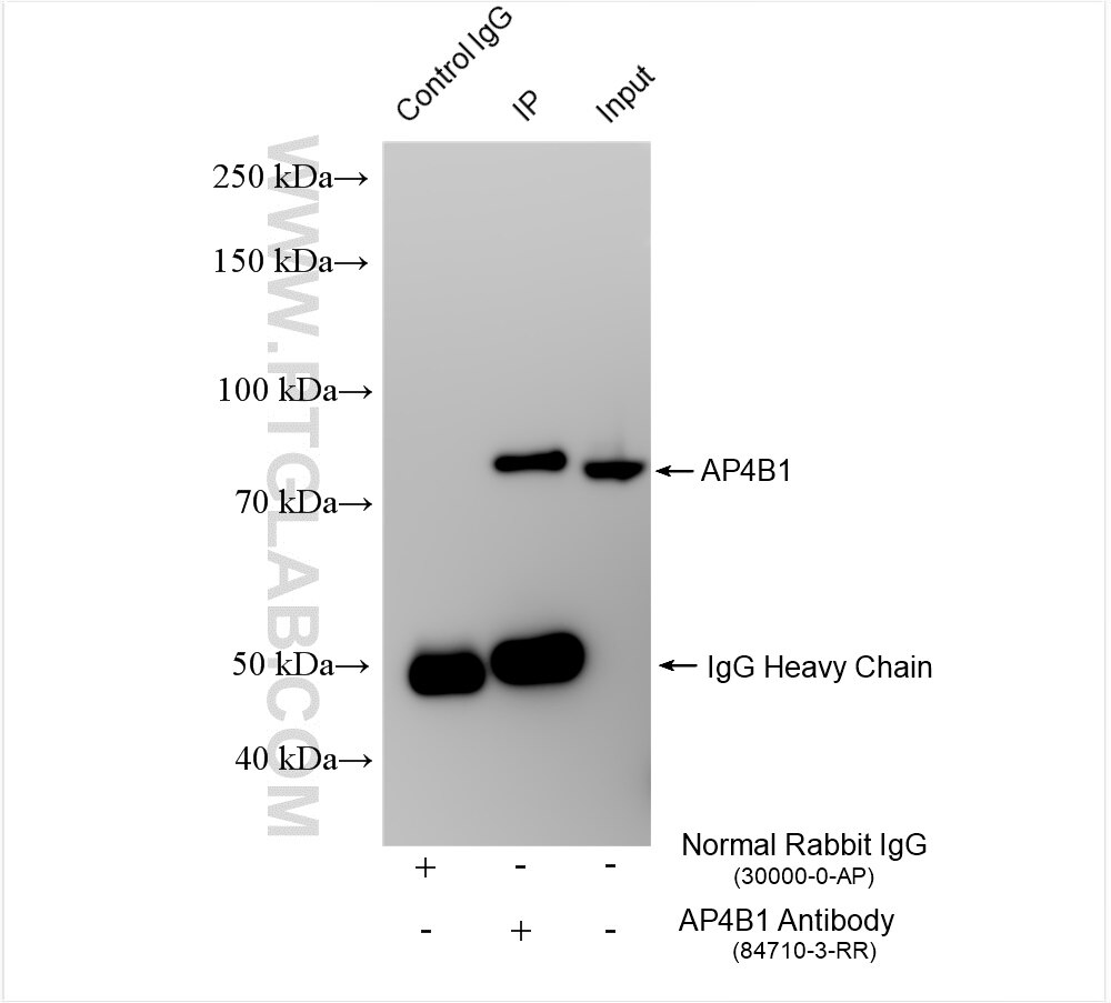 Immunoprecipitation (IP) experiment of HeLa cells using AP4B1 Recombinant antibody (84710-3-RR)