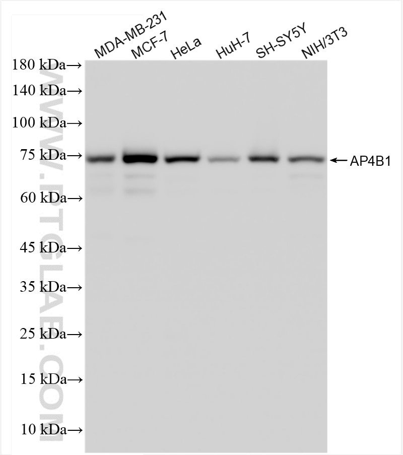Western Blot (WB) analysis of various lysates using AP4B1 Recombinant antibody (84710-3-RR)
