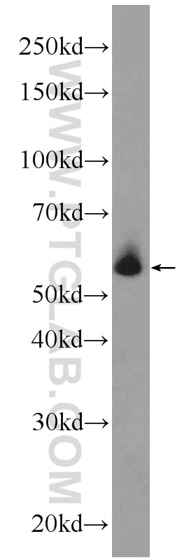 Western Blot (WB) analysis of A431 cells using AP4M1 Polyclonal antibody (11653-1-AP)