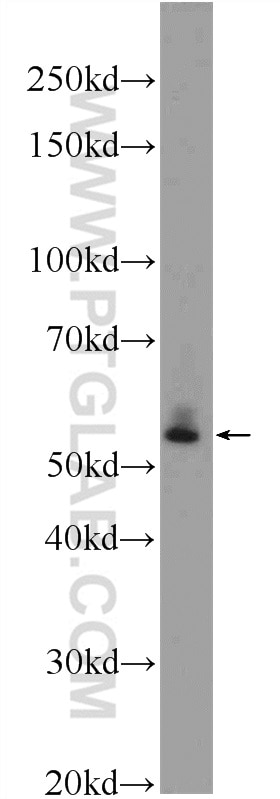 Western Blot (WB) analysis of HeLa cells using AP4M1 Polyclonal antibody (11653-1-AP)