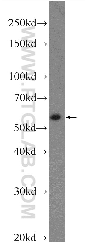 Western Blot (WB) analysis of mouse lung tissue using AP4M1 Polyclonal antibody (11653-1-AP)