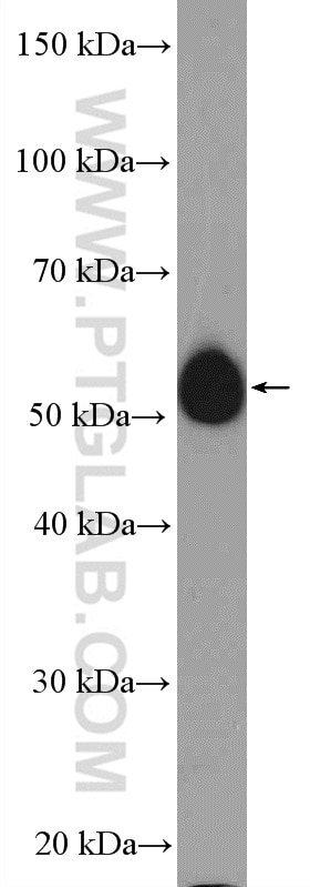 Western Blot (WB) analysis of mouse heart tissue using AP4M1 Polyclonal antibody (11653-1-AP)