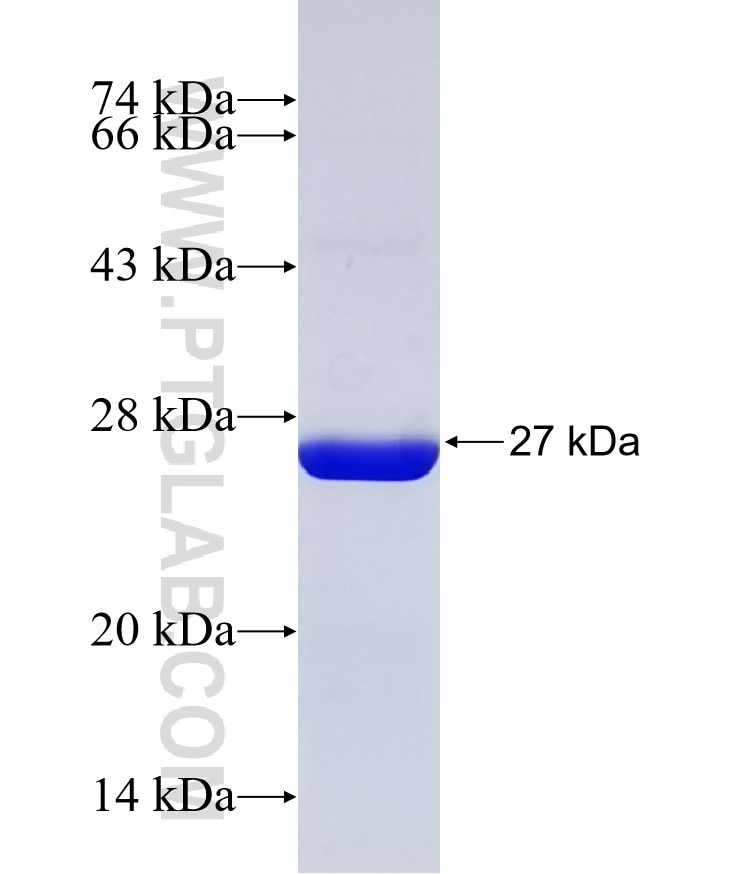 AP4M1 fusion protein Ag32292 SDS-PAGE AP4M1 fusion protein Ag32292 SDS-PAGE